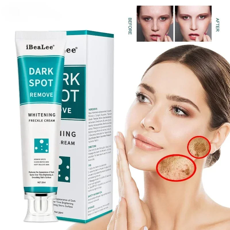Skincare Glowing - Crema sbiancante per lentiggini Rimuovi macchie