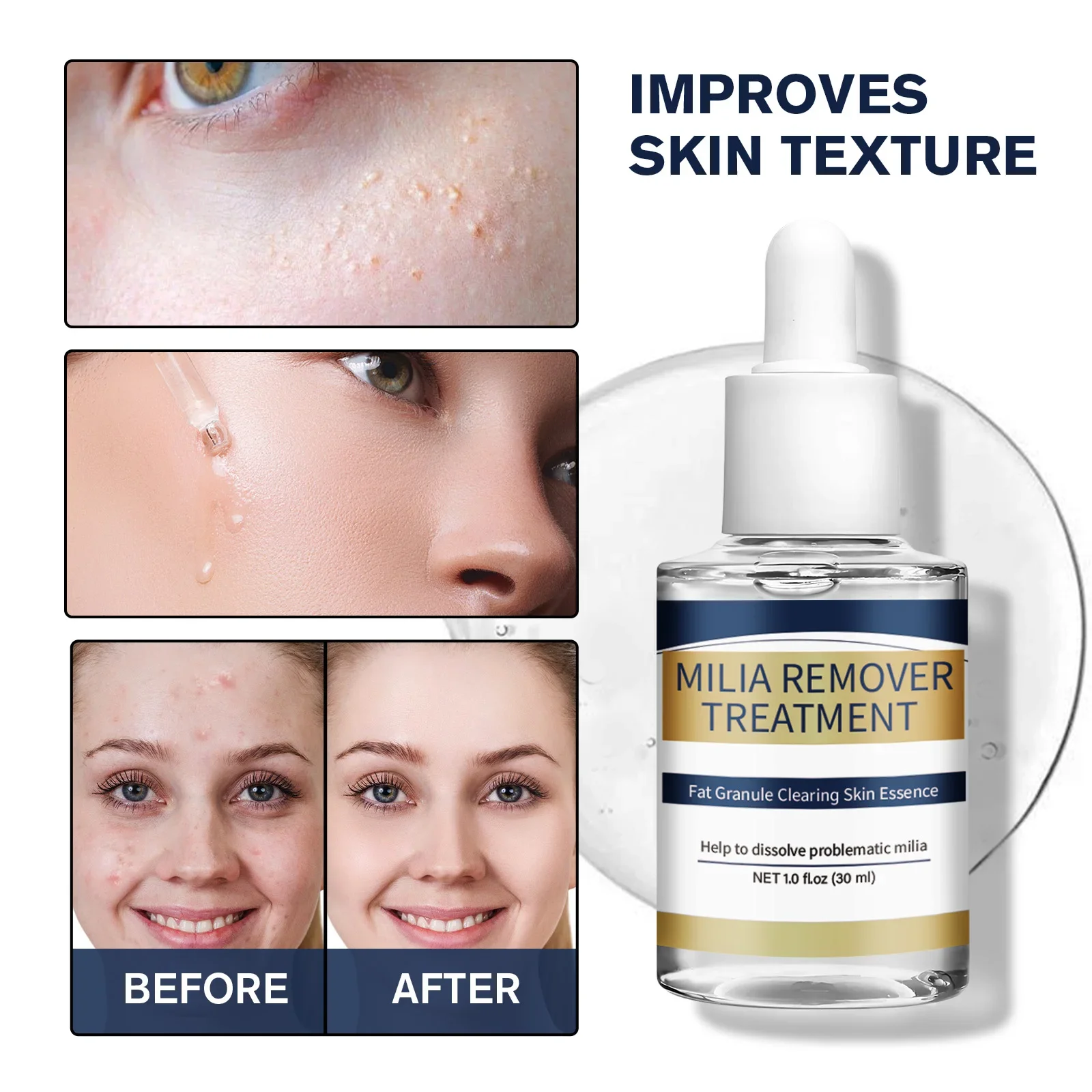 Hyaluronic Acid Serum - Milia Remover Essenza Trattamento Grasso Granulo