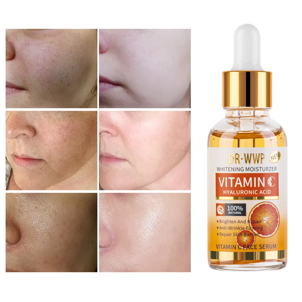 Disaar vitamina C 30ml siero v - Skincare Garnier recensione e prezzo