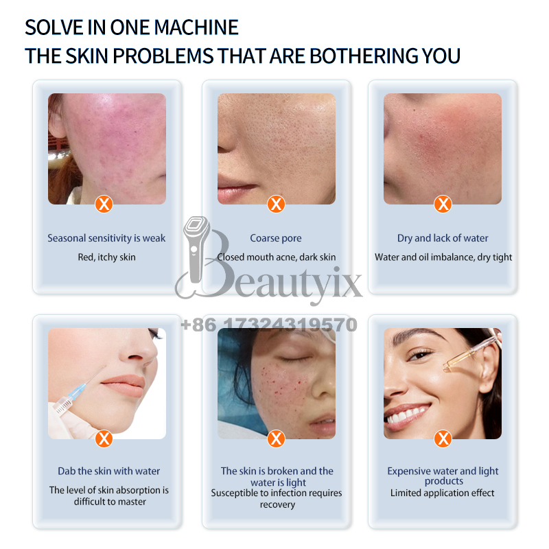 Nuovissima Macchina per Tratta - Skincare Ls recensione e prezzo