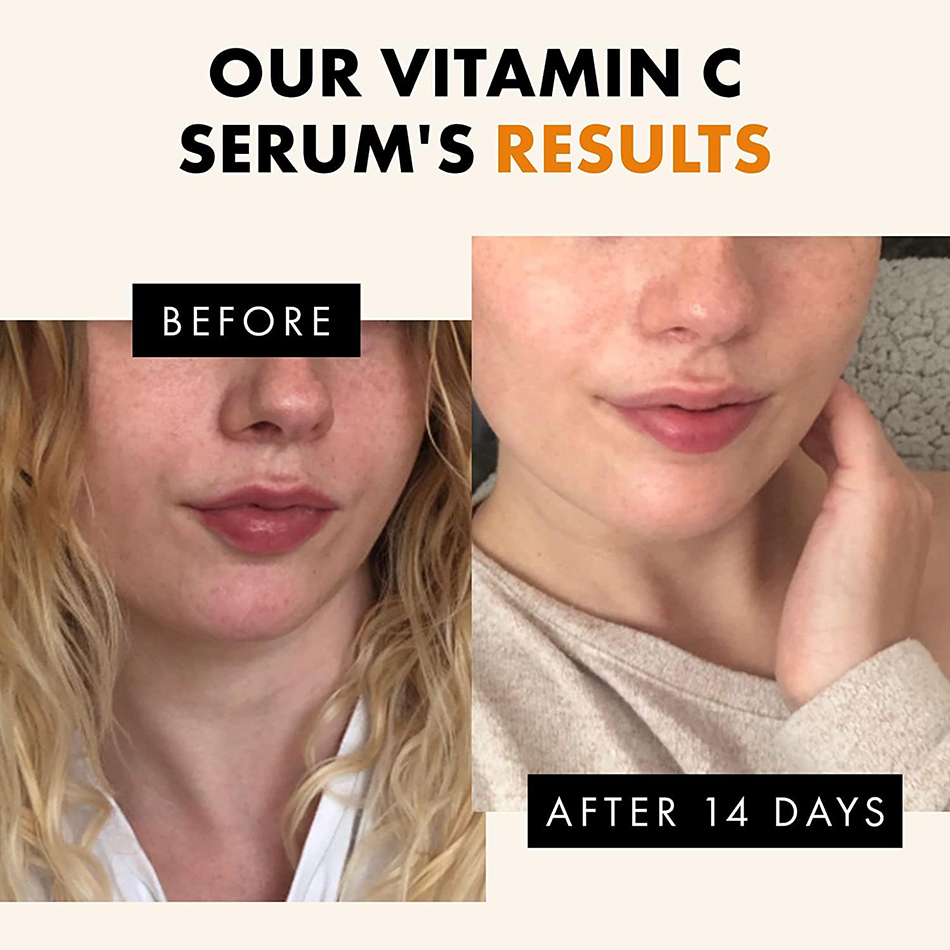 120ml 99% vitamina C siero oli - Skincare Garnier recensione e prezzo