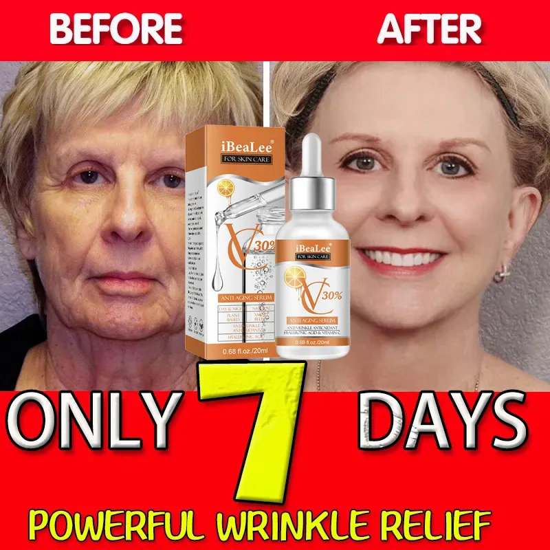 Premium 30% vitamina C siero p - Skincare Garnier recensione e prezzo
