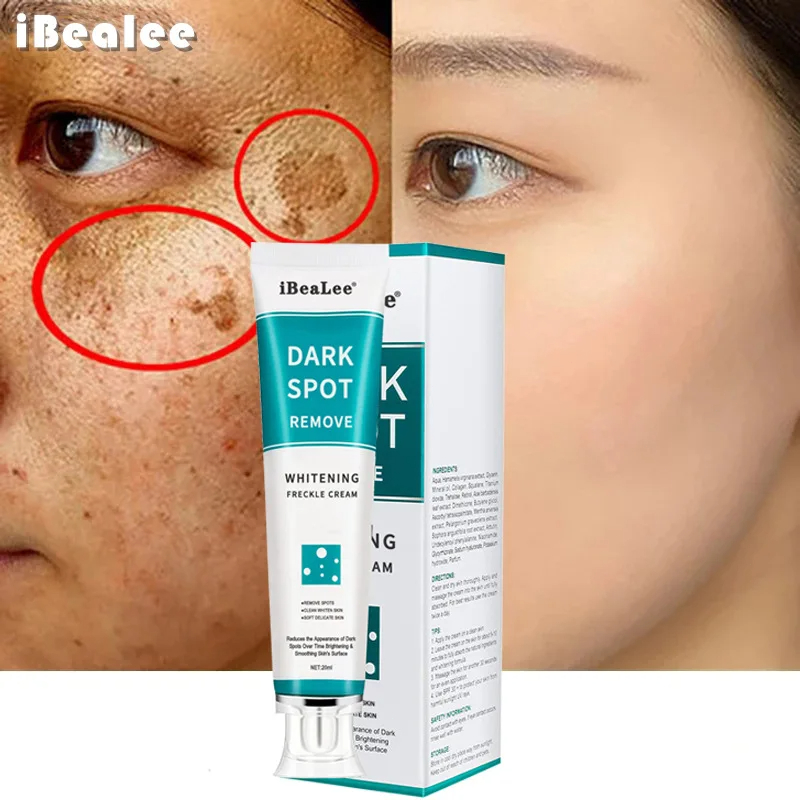 Crema sbiancante per lentiggin - Skincare Glowing recensione e prezzo