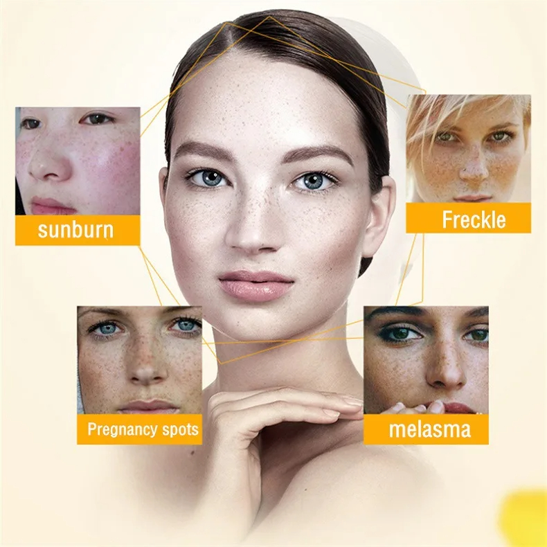 Crema sbiancante per lentiggin - Skincare Glowing recensione e prezzo