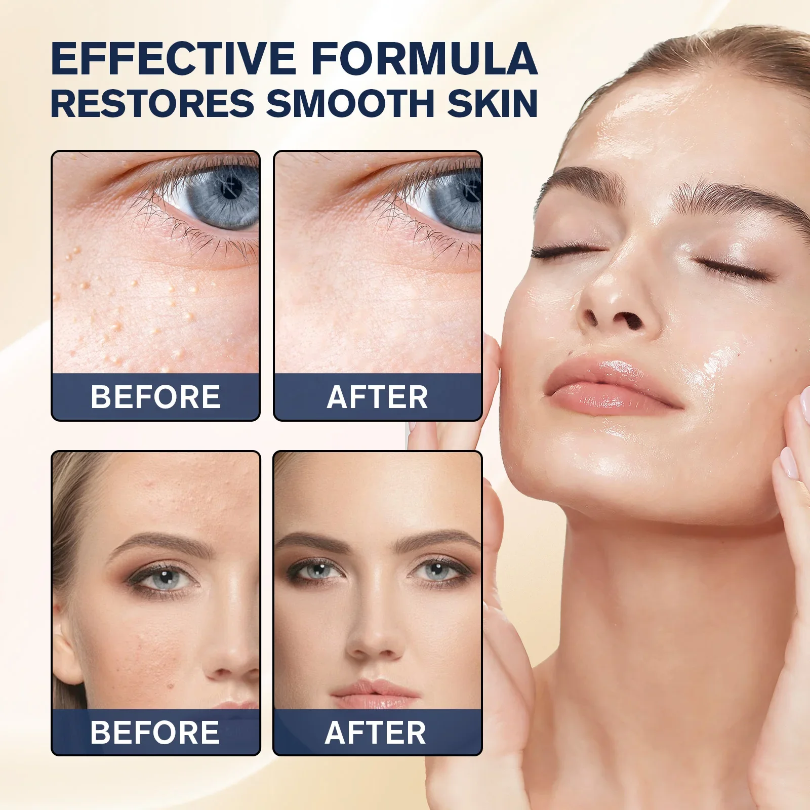 Milia Remover Essenza Trattame - Hyaluronic Acid Serum recensione e prezzo