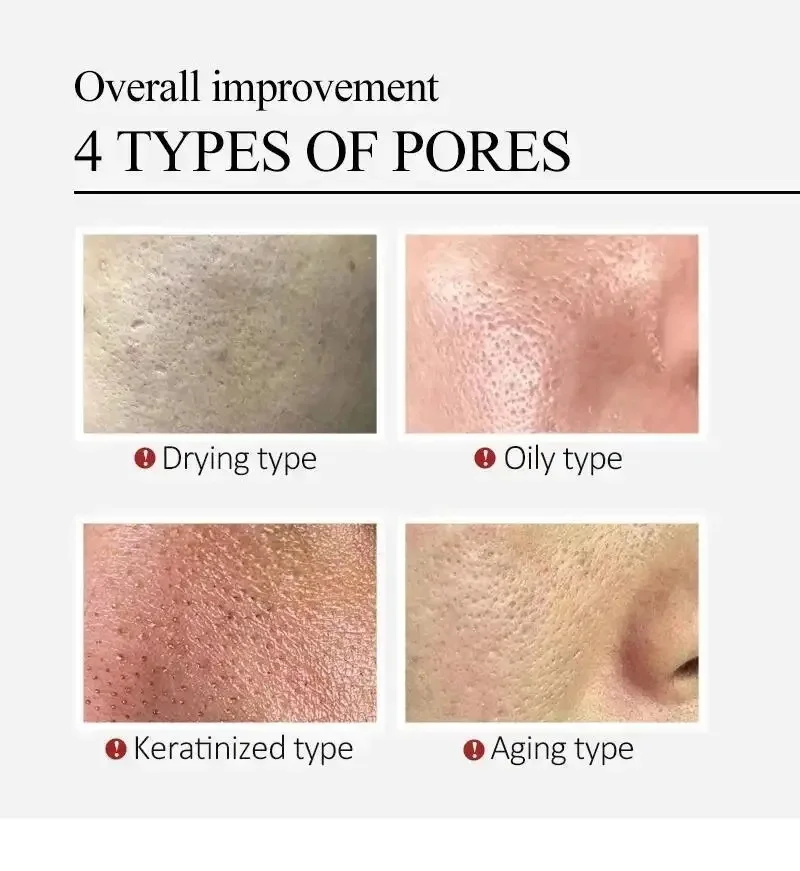 Siero Viso alla Centella Asiat - Centella Asiatica Toner recensione e prezzo