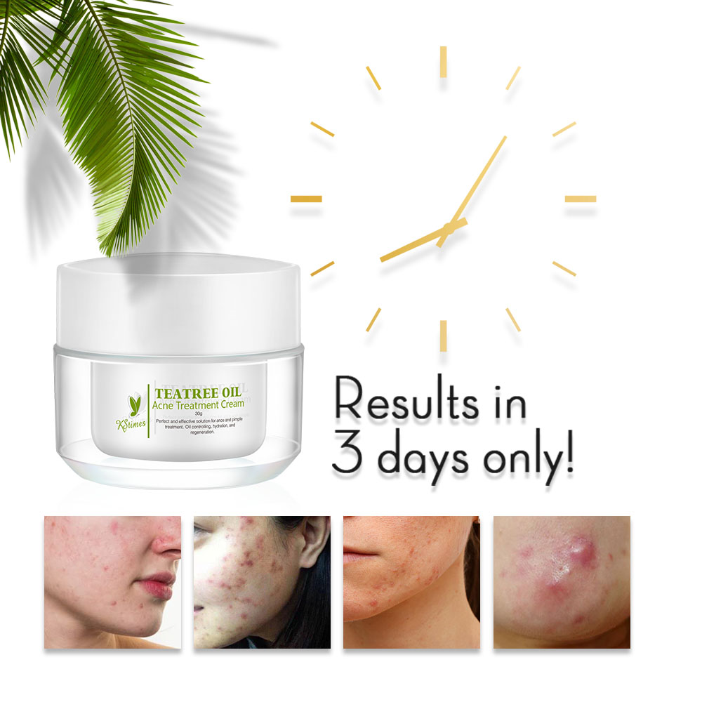 Kstim trattamento naturale del - Tea Tree Spot Treatment recensione e prezzo